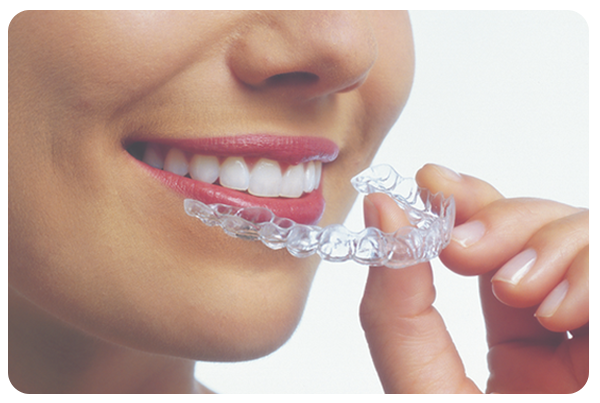 Invisalign