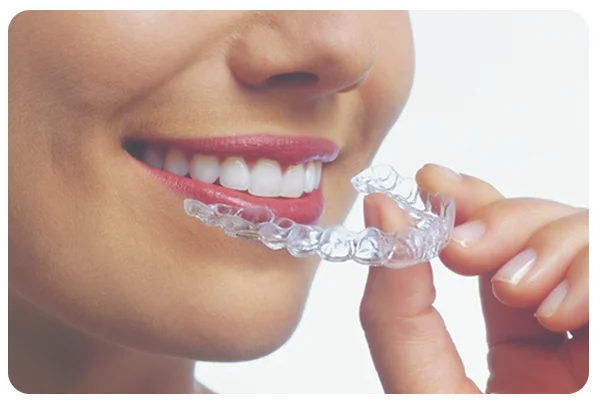 Invisalign