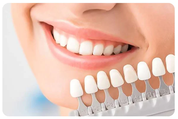 Teeth Whitening